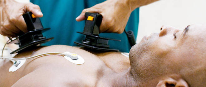 Santé: focus sur le défibrillateur cardiaque